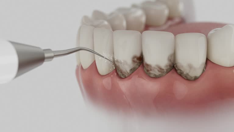 Trusted Tooth Extraction service in Bruce, MS - Dentist Open Now
